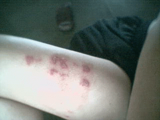 5.GIF